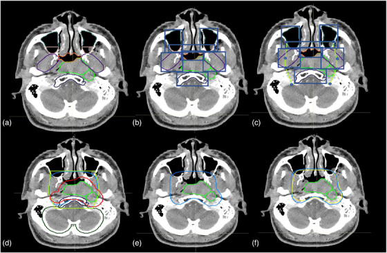 FIGURE 2