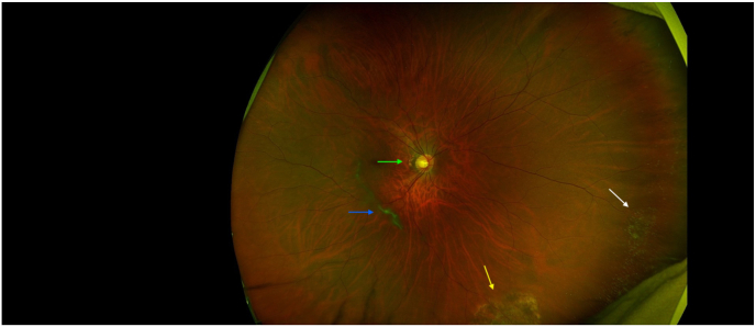 Fig. 1