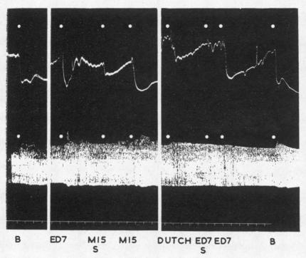 graphic file with name brjindmed00197-0034-a.jpg