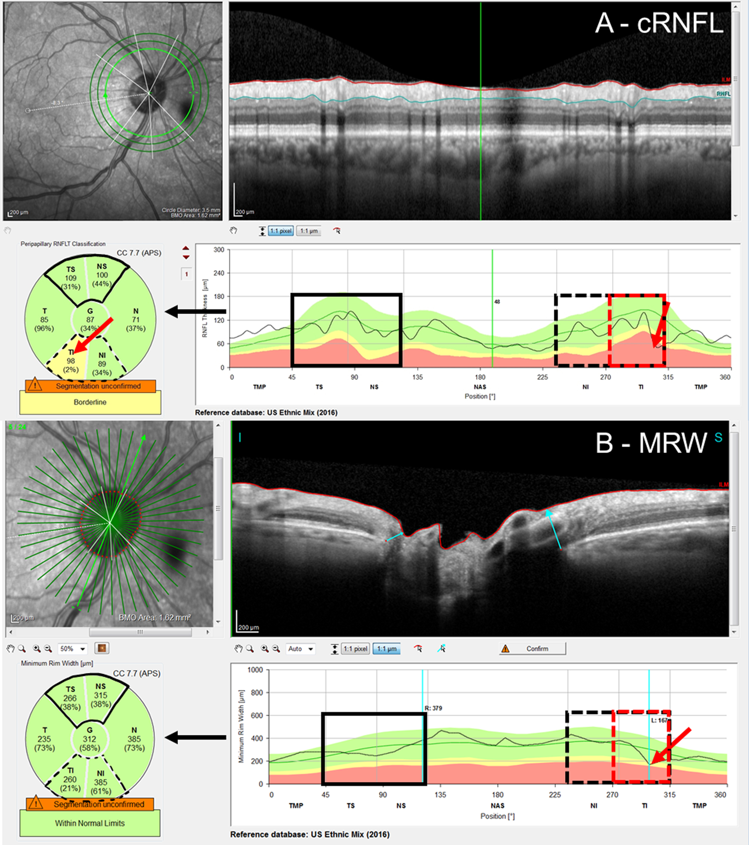 Figure 1: