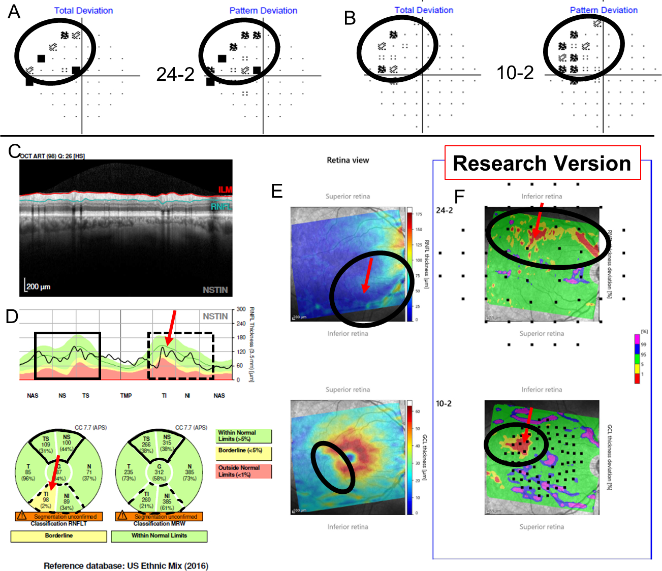 Figure 2: