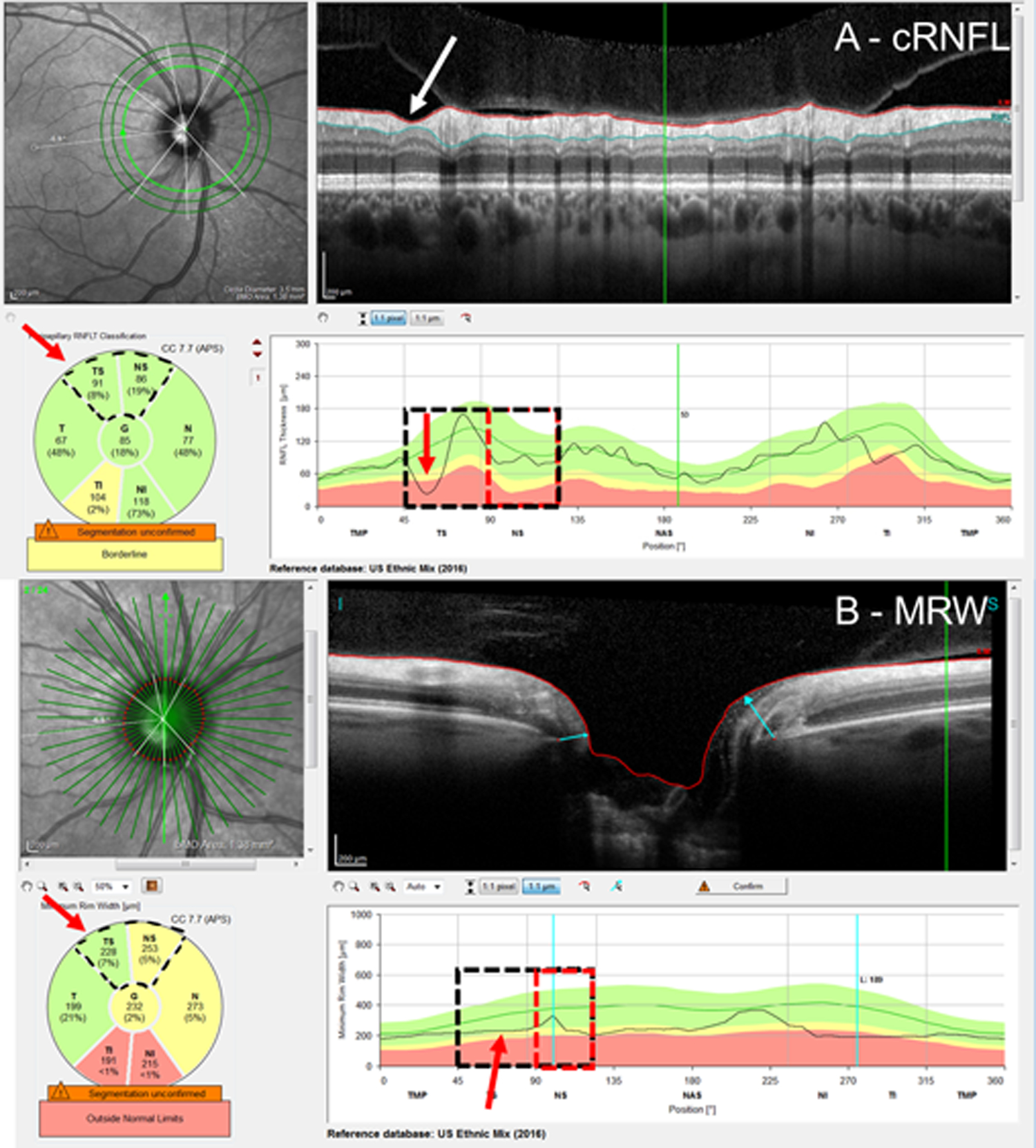 Figure 3: