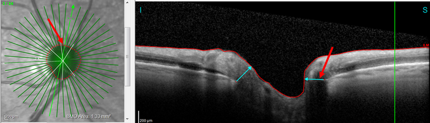 Figure 7: