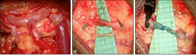 Fig. 4