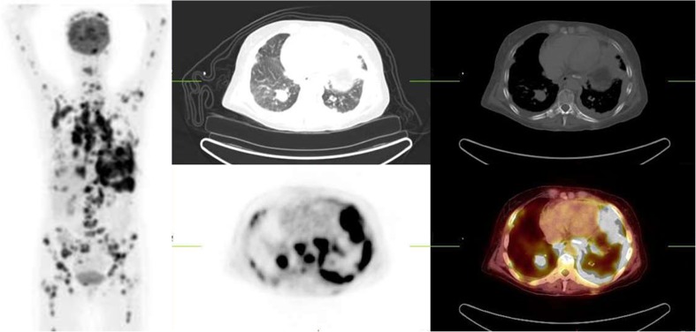 Fig. 2