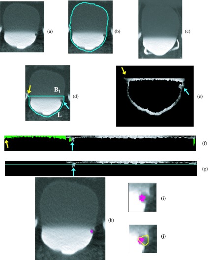 FIG. 4.