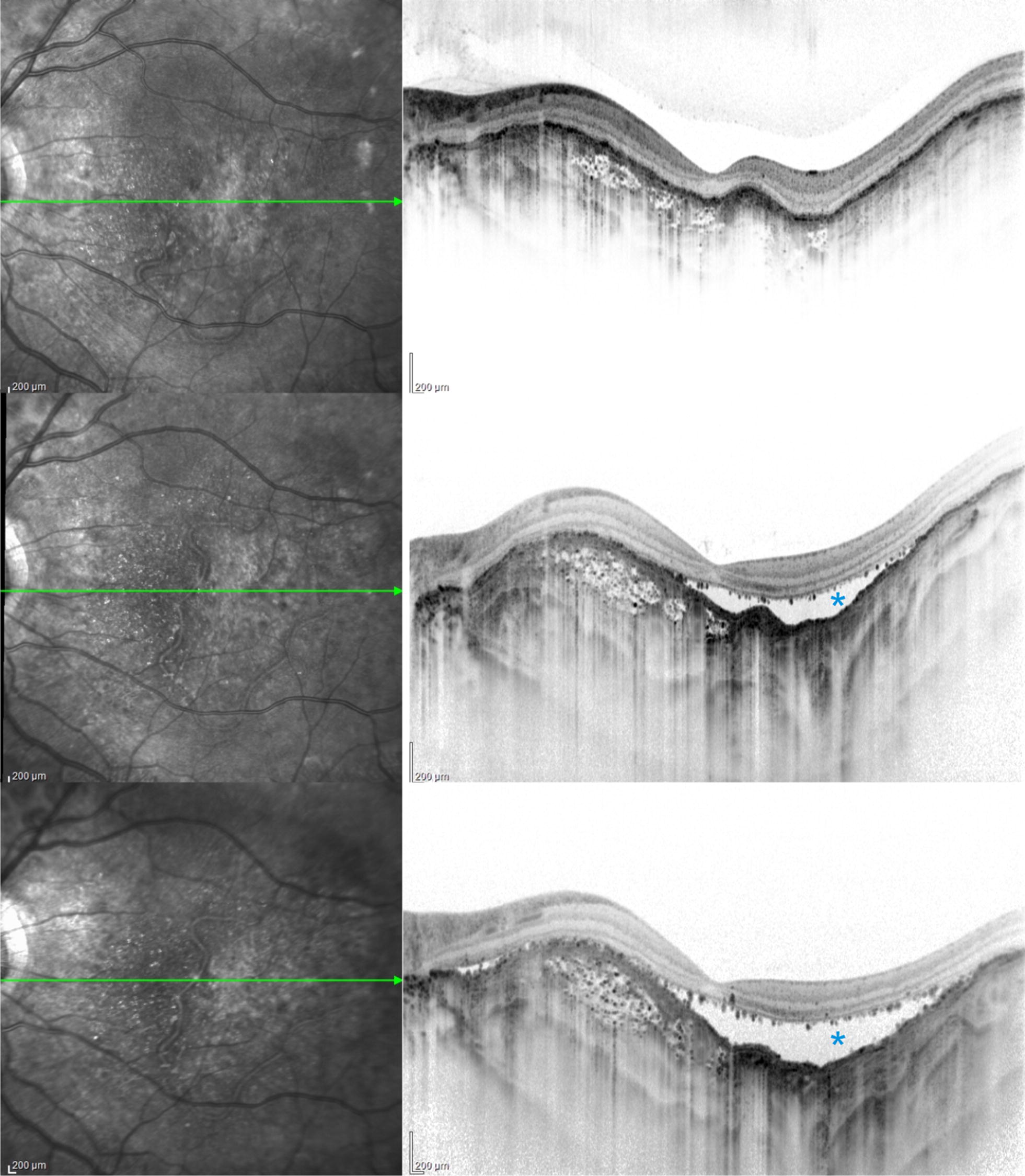 Fig. 3