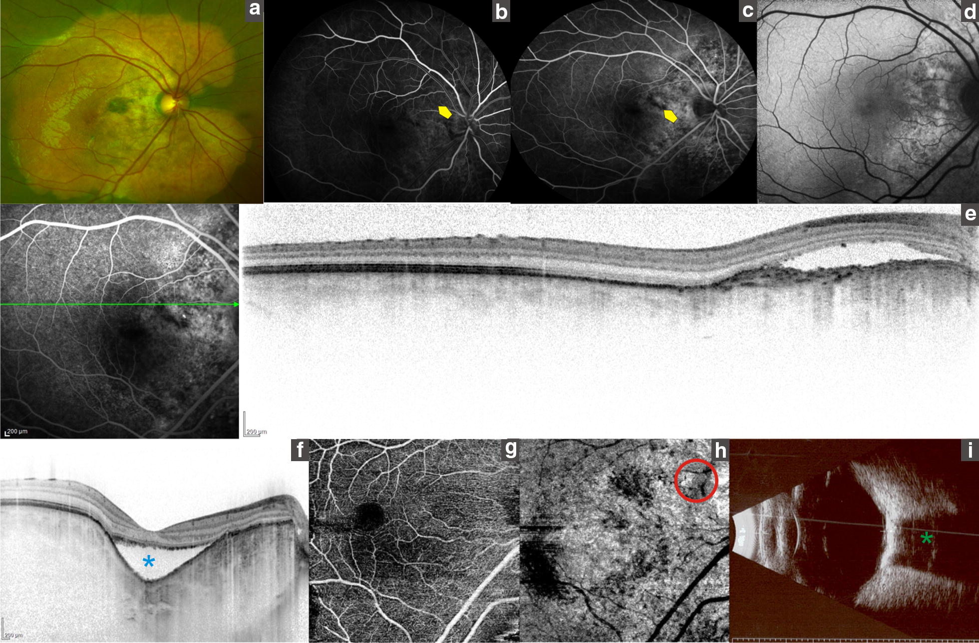 Fig. 1