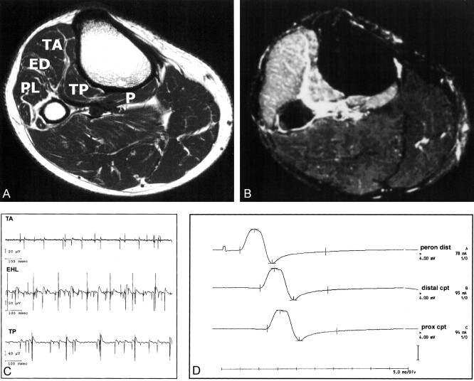 Fig 2.