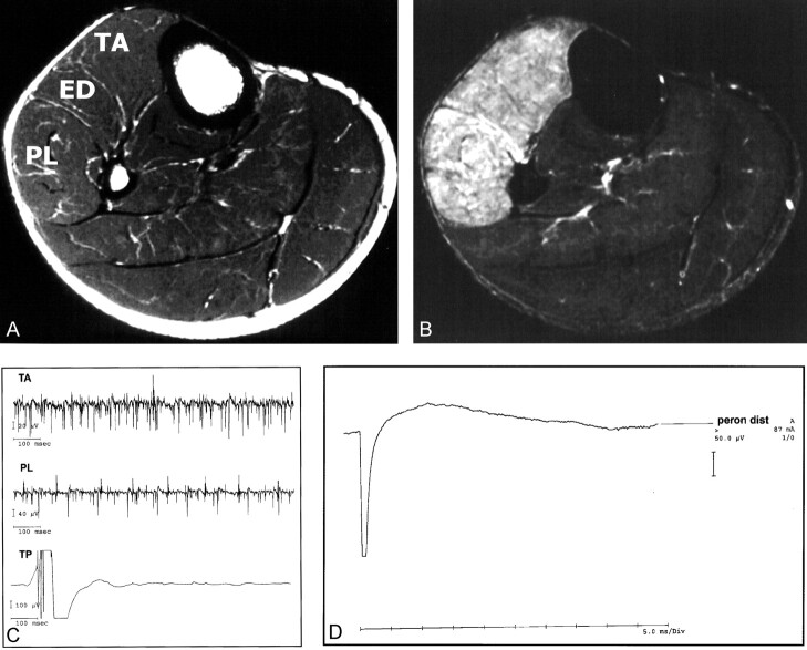 Fig 1.