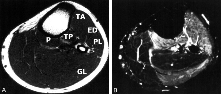 Fig 4.