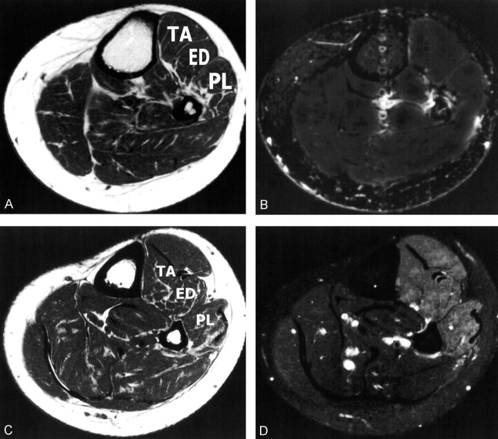 Fig 5.