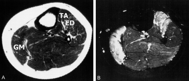 Fig 3.