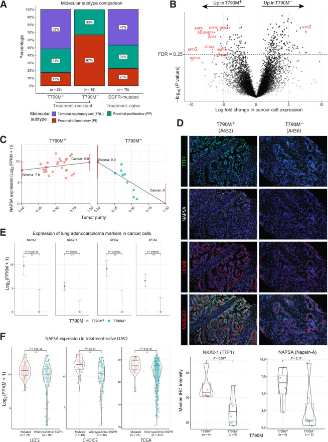 Figure 2. Tumor transcriptomic correlates of EGFR TKI resistance. A, Proportions of molecular transcriptomic subtype assigned to EGFR TKI-resistant tumors and treatment-naïve EGFR-mutated tumors. B, Volcano plot of log10(P values) against log-fold change in cancer cell expression of all genes tested. Lung adenocarcinoma markers (NAPSA, NKX2–1, SFTA2, and SFTA2) and other pulmonary differentiation markers are highlighted in red (Supplementary Table S4). C, Illustration of tumor transcriptome deconvolution approach for napsin-A (NAPSA). NAPSA gene expression is strongly correlated with purity in T790M− but not T790M+ tumors. NAPSA expression is inferred for a tumor with 0% (stroma) and 100% (cancer) tumor purity. Only lung tumor tissue and samples without abnormal high expression of squamous or neuroendocrine related genes are used for (B) and (C). D, Multiplex IHC staining of NAPSA, NKX2–1, and L858R (Surrogate for cancer cells). Images shown represent two tumors with striking difference in the IHC staining. Bottom, Bar–violin plots compare the median IHC intensity in NAPSA and NKX2–1 in all cells stained for L858R for each individual tumor with IHC data available. E, Cancer cell expression of lung adenocarcinoma markers comparing T790M+ and T790M− cohorts. F, Bulk tumor expression of lung adenocarcinoma markers comparing treatment-naïve EGFR-mutated and EGFR wild-type tumors across three public cohorts.