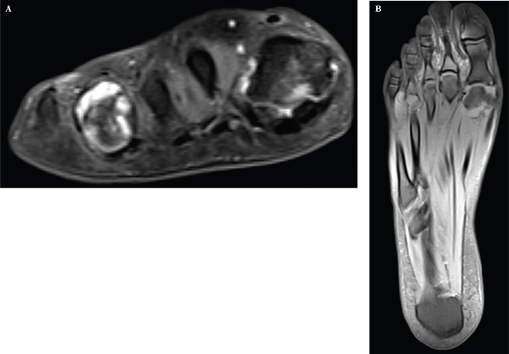 Fig. 11