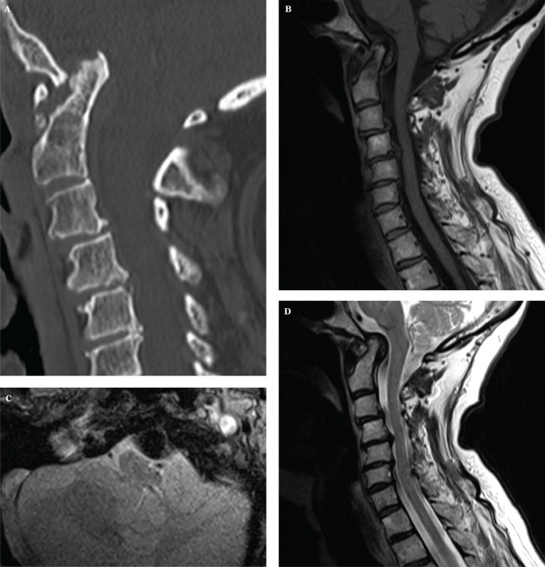 Fig. 13