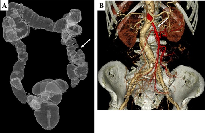 Fig. 2