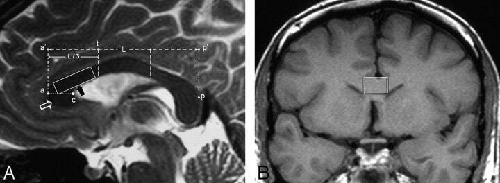 Fig 1.