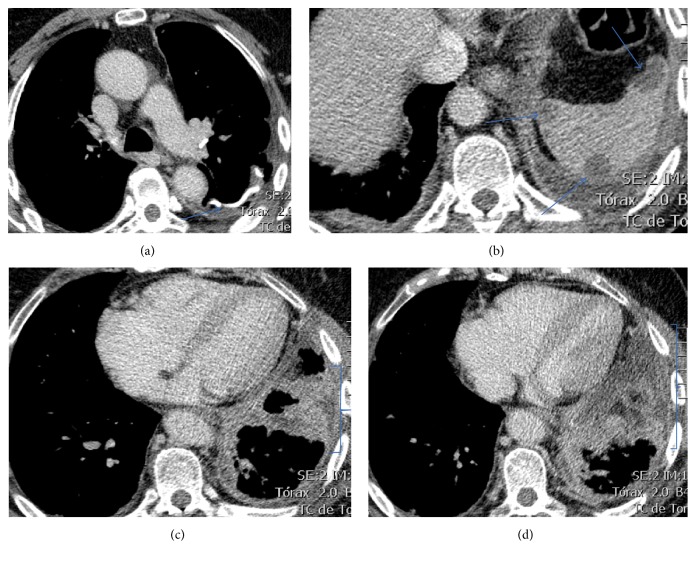 Figure 11