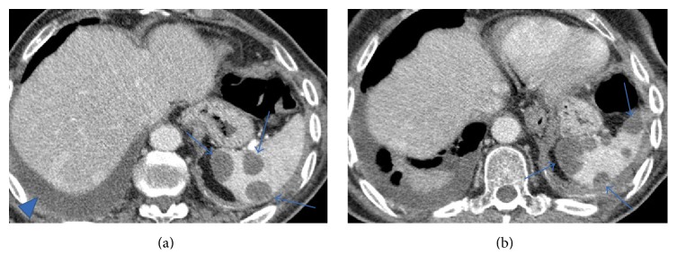 Figure 13