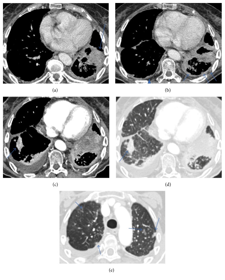 Figure 12