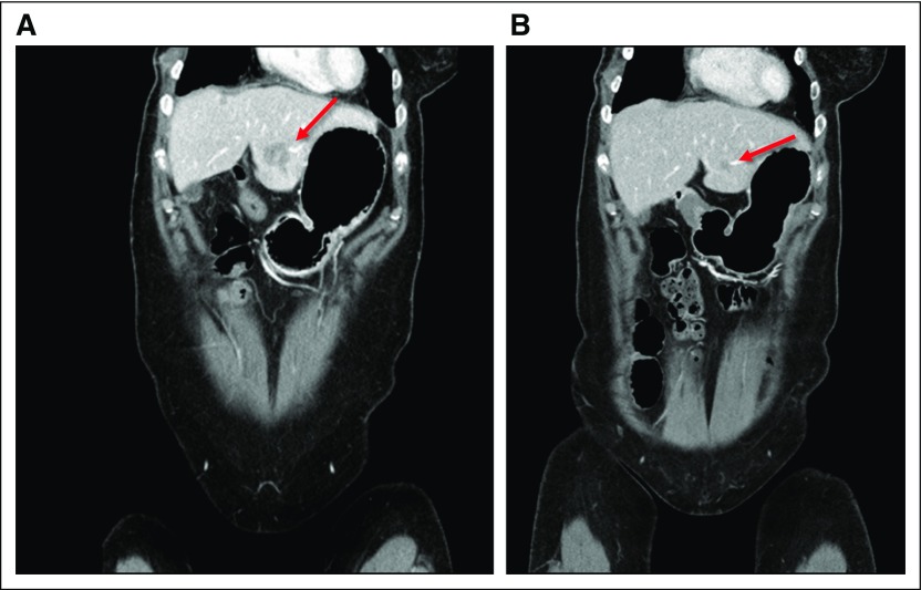 Fig 3.