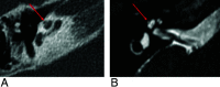 FIG 8.