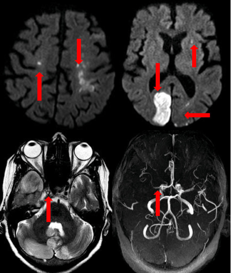 Fig 3