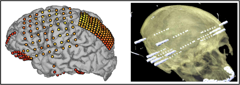 Figure 1: