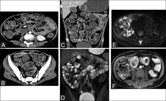 Figure 6 (A-F)