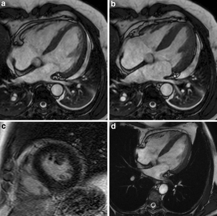 Fig. 2