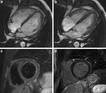 Fig. 4