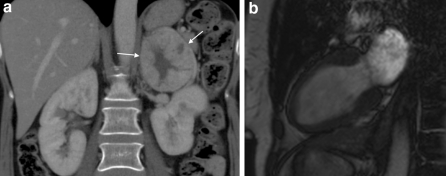 Fig. 5