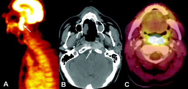 Fig 1.