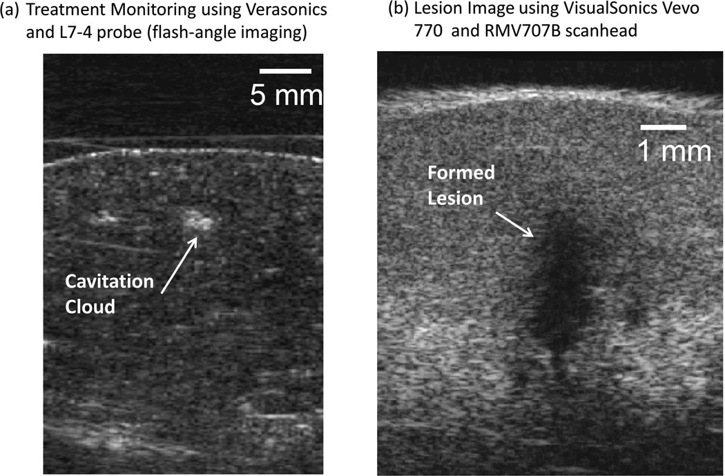 Fig. 11