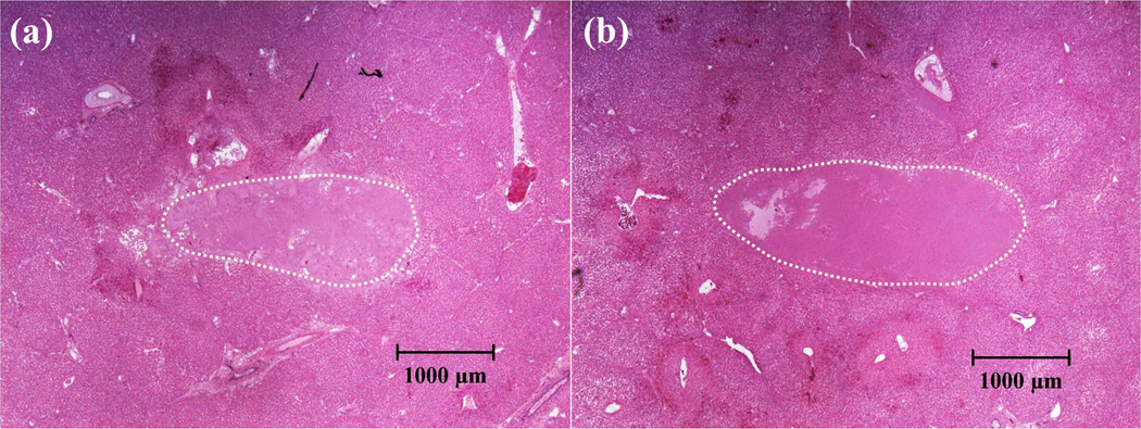 Fig. 12