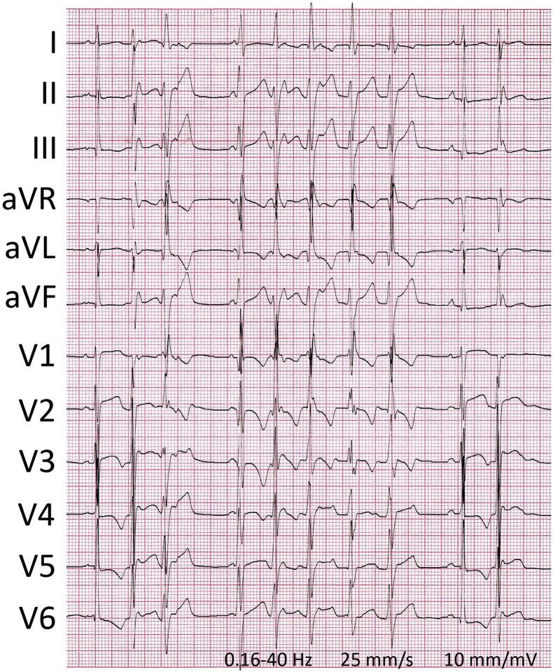 Figure 2