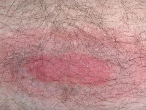 Fig. 16.4