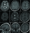 [Table/Fig-9]:
