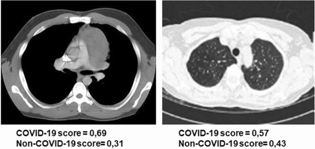 Fig. 10
