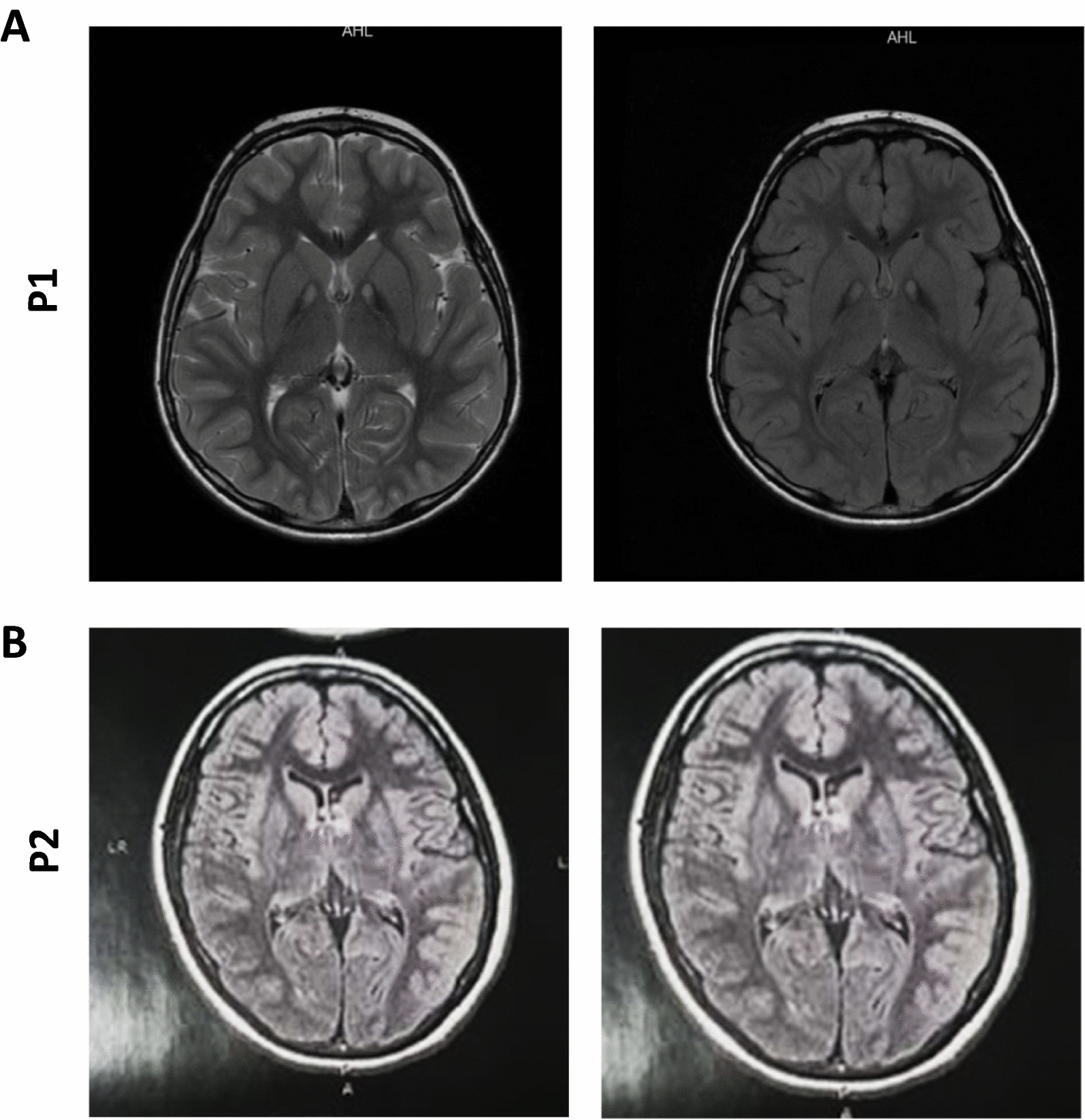 Fig. 1