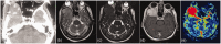 Figure 12.