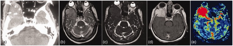 Figure 12.