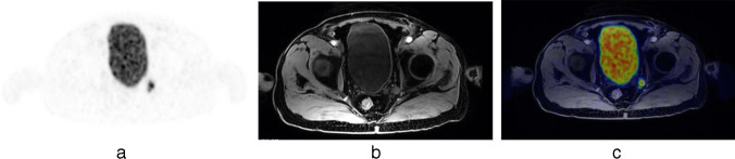 Fig. 1