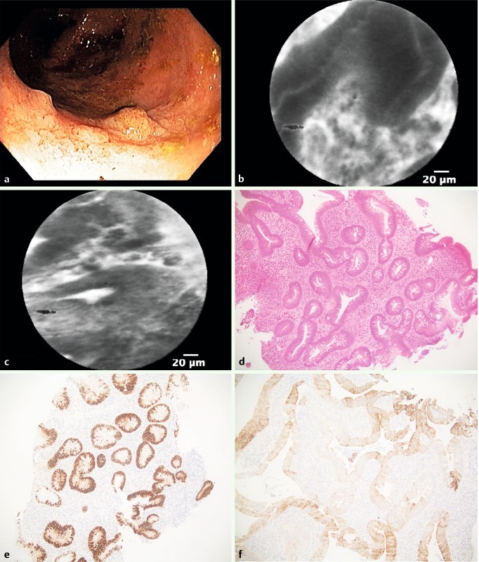 Fig. 3