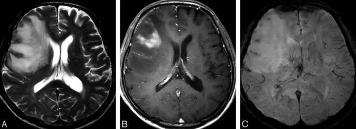 Fig 4.