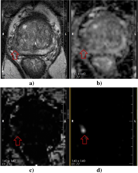 Fig. 5