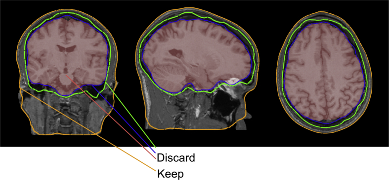 Fig. 2