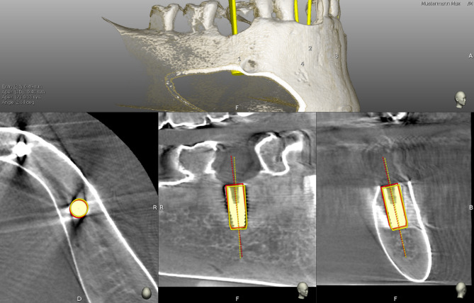 Fig. 5