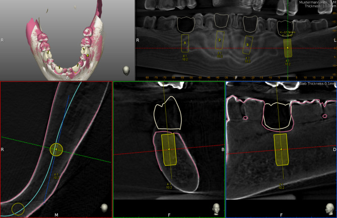 Fig. 3
